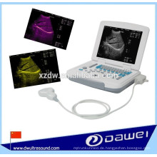 Laptop medizinische Ultraschallgeräte und tragbare Ultraschalldiagnosescanner